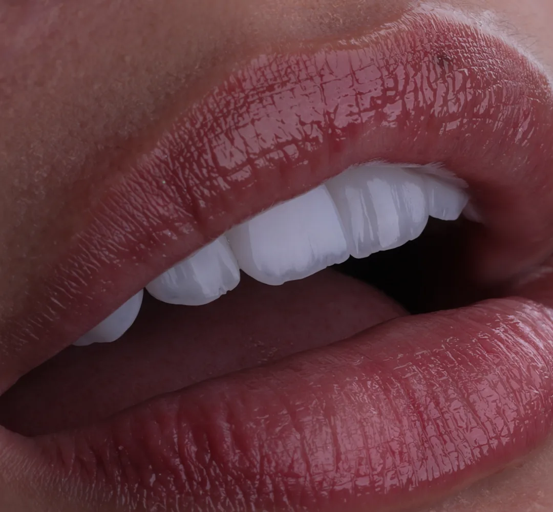 Close lateral do sorriso de uma mulher